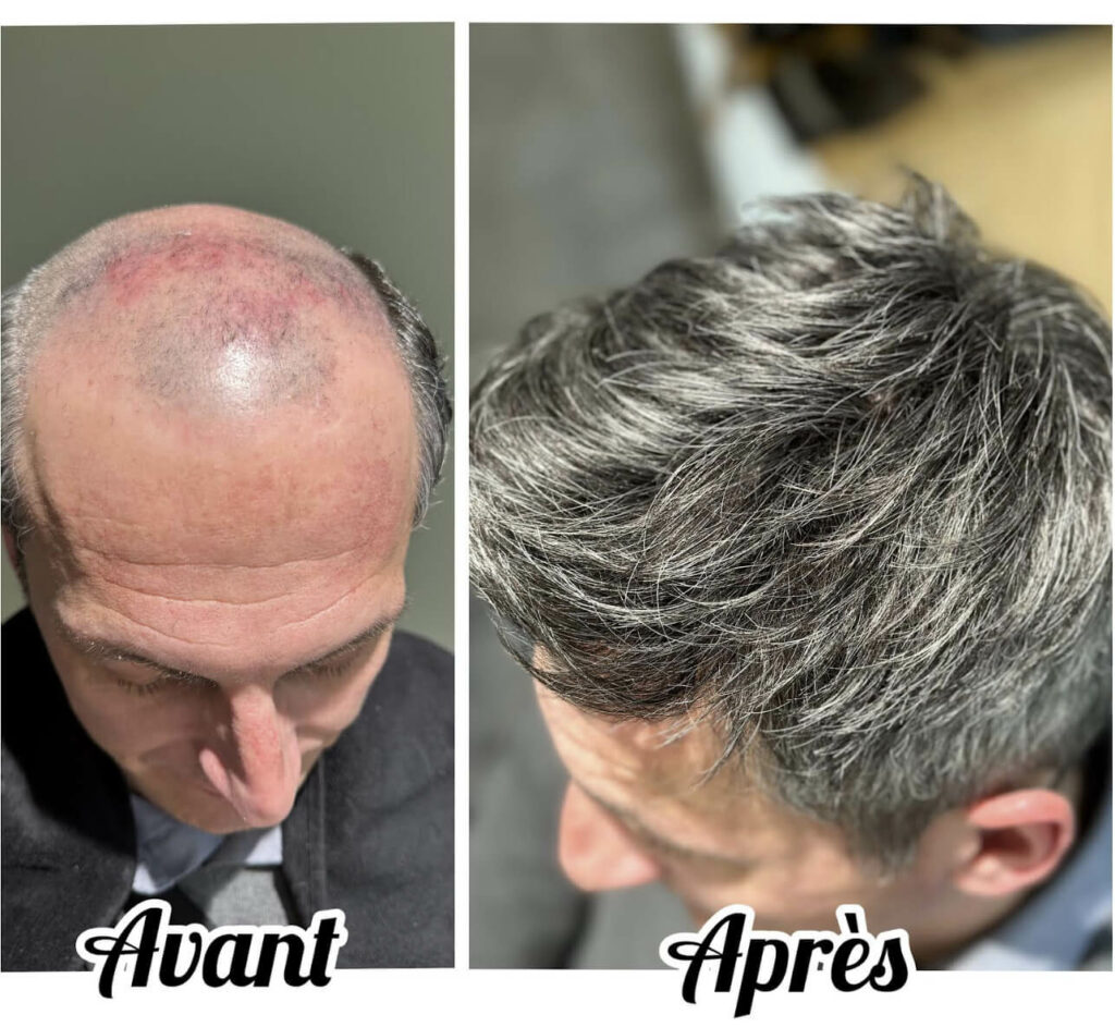 confort maintien et legerte au quotidien - albres contades strasbourg