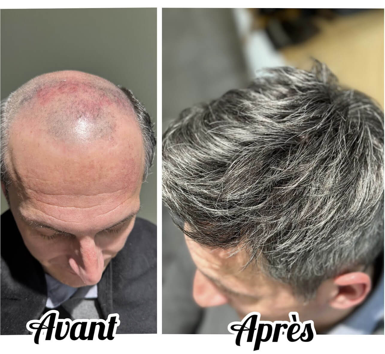 confort maintien et legerte au quotidien - albres contades strasbourg