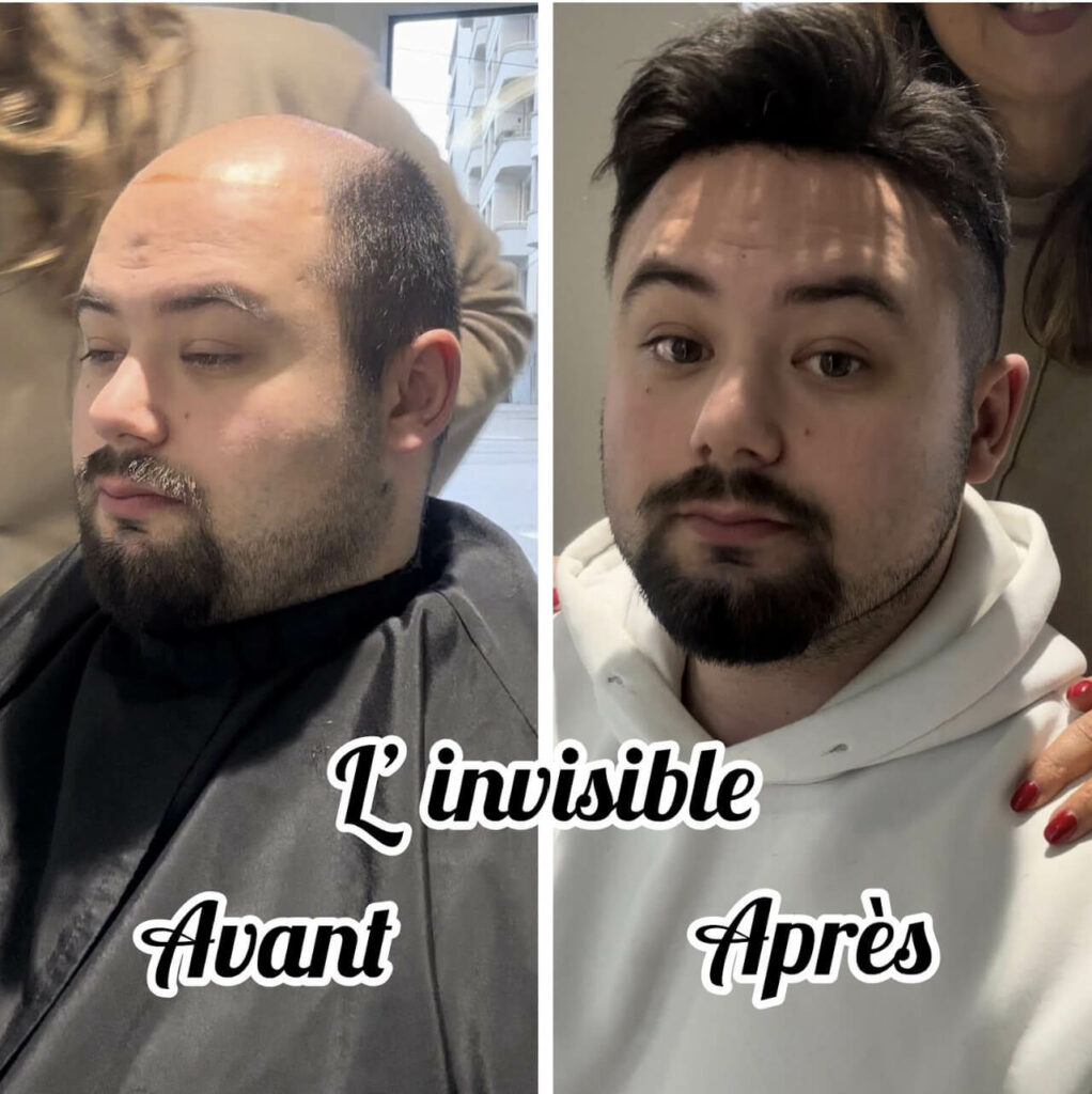 invisible cheveux pour retrouver la coupe dont vous revez - albres contades strasbourg
